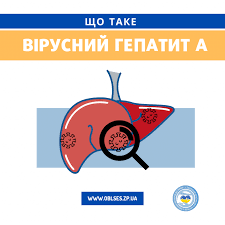 Вірусний гепатит А