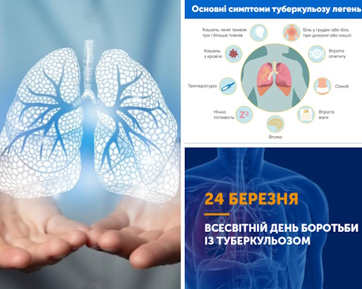 24 березня - Всесвітній день боротьби з туберкульозом